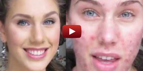 American Homes and Gardens Health Video